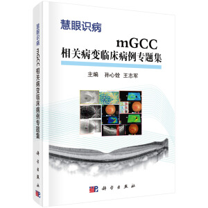 mGCCP(gun)׃R(zhun)}