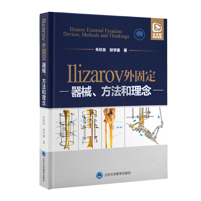 Ilizarov̶е