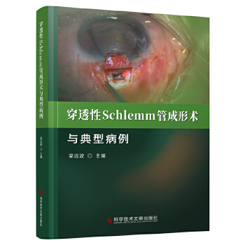  ͸SchlemmܳgcͲ
