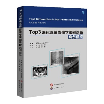  Top3ϵy(tng)ӰWbe\