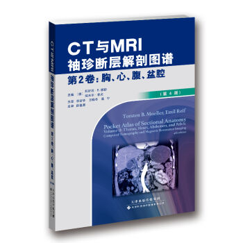 CTcMRIӽʈDV 2-ءǻ