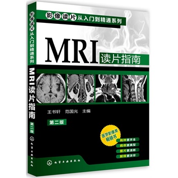 ӰxƬTͨϵ--MRIxƬָ(ڶ)(t(y)W(xu)ӰN(sh)(j)ٰ棬NRȫͣDƬጸԔM)